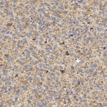 EIF2AK1 Rabbit Polyclonal Antibody