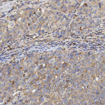 EIF2AK1 Rabbit Polyclonal Antibody