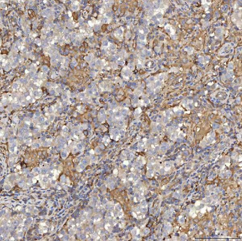 EIF2AK1 Rabbit Polyclonal Antibody