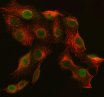 ABI2 Rabbit Polyclonal Antibody