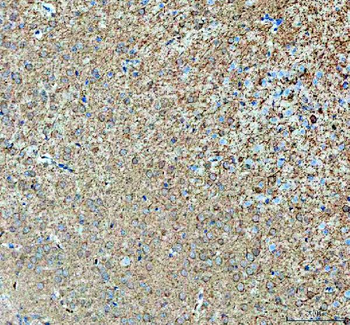 ABI2 Rabbit Polyclonal Antibody