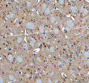 ABI2 Rabbit Polyclonal Antibody