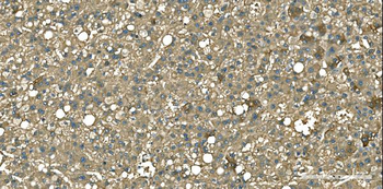 Aspartate Aminotransferase/GOT1 Mouse Monoclonal Antibody