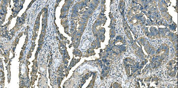 Aspartate Aminotransferase/GOT1 Mouse Monoclonal Antibody
