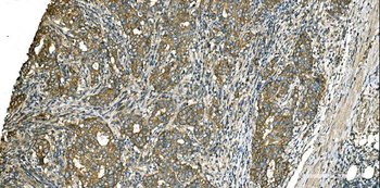 Aspartate Aminotransferase/GOT1 Mouse Monoclonal Antibody