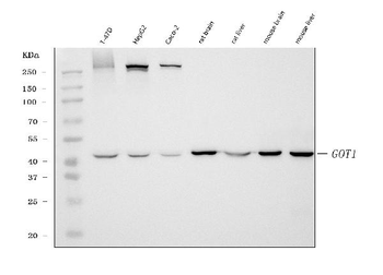 Aspartate Aminotransferase/GOT1 Mouse Monoclonal Antibody