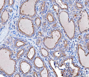 KLHL12 Antibody (monoclonal, 2G11D1)