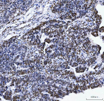 Lamin A+C/LMNA Antibody (monoclonal, 5F3C12)