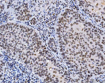 Lamin A+C/LMNA Antibody (monoclonal, 5F3C12)