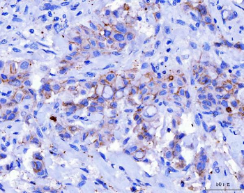 Desmoglein 2/DSG2 Mouse Monoclonal Antibody
