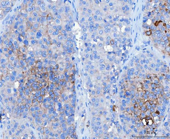 Desmoglein 2/DSG2 Mouse Monoclonal Antibody