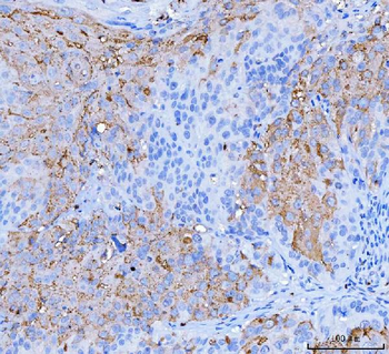Desmoglein 2/DSG2 Mouse Monoclonal Antibody