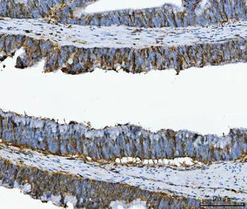 Annexin A1/ANXA1 Antibody (monoclonal, 6B7F8)