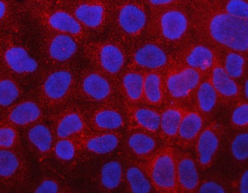 PLCD3 Rabbit Polyclonal Antibody