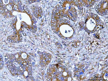 PDXDC1 Antibody
