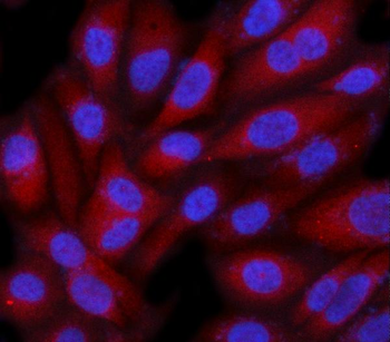 C19orf61/SMG9 Rabbit Polyclonal Antibody