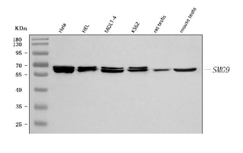 C19orf61/SMG9 Rabbit Polyclonal Antibody