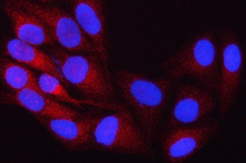 OSBPL8 Rabbit Polyclonal Antibody