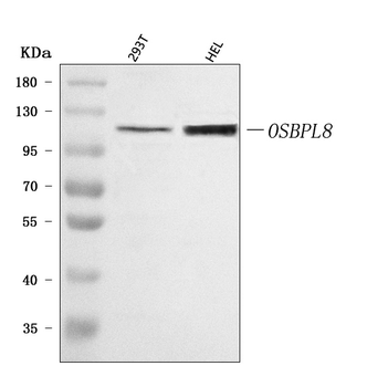 OSBPL8 Rabbit Polyclonal Antibody
