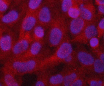 PGAM1 Rabbit Polyclonal Antibody