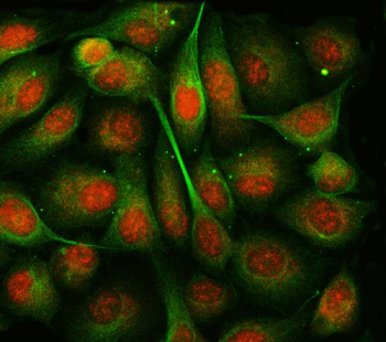 TSEN54 Rabbit Polyclonal Antibody
