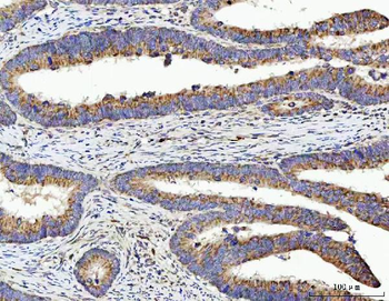 TSEN54 Rabbit Polyclonal Antibody