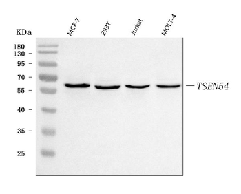 TSEN54 Rabbit Polyclonal Antibody