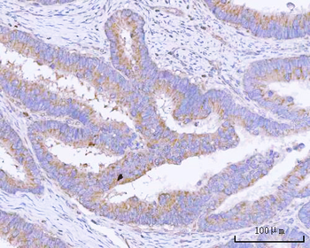 PITPNB Antibody
