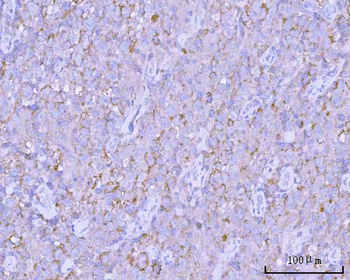 PITPNB Antibody