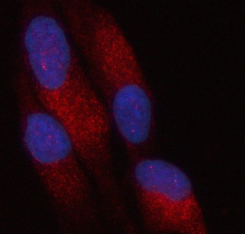 PATL2 Rabbit Polyclonal Antibody