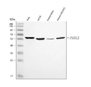PATL2 Rabbit Polyclonal Antibody