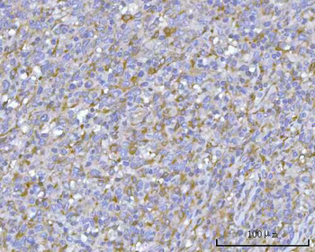 PACSIN2 Rabbit Polyclonal Antibody