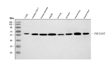 PACSIN2 Rabbit Polyclonal Antibody