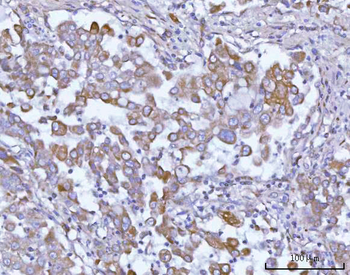OSGIN1 Rabbit Polyclonal Antibody
