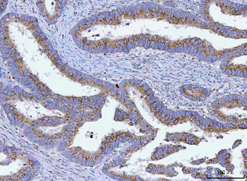 TMEM87A Antibody