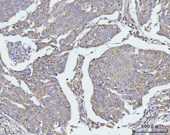 TMEM87A Antibody