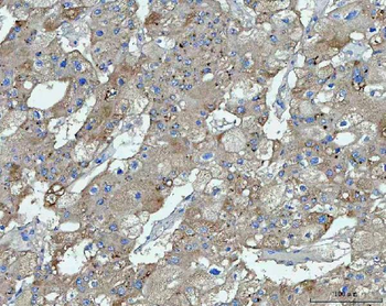TMEM87A Antibody