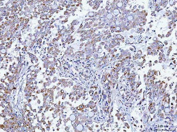 TMEM87A Antibody
