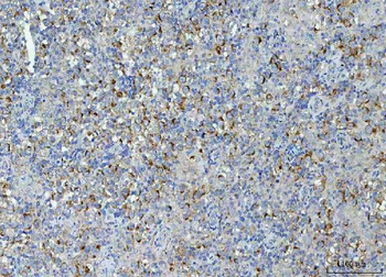 TMEM87A Antibody