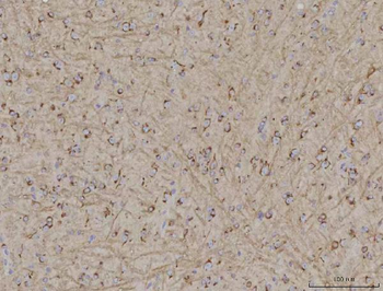 TMEM87A Antibody
