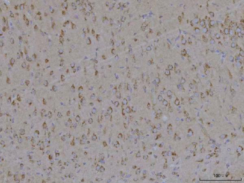 TMEM87A Antibody