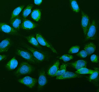 RPS14 Antibody