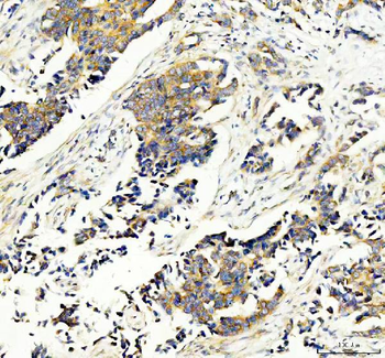 RPS14 Antibody