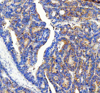RPS14 Antibody
