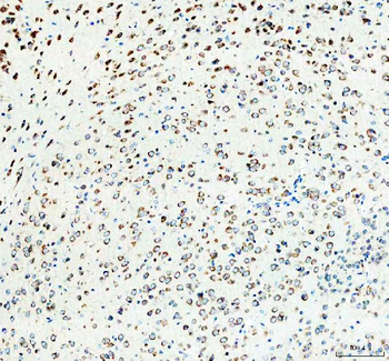 RPS14 Antibody
