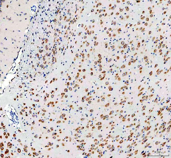 RPS14 Antibody
