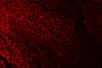 RPRD1B Antibody