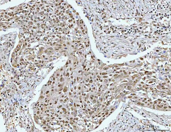 RPRD1B Antibody