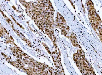 RPRD1B Antibody