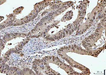 RPRD1B Antibody
